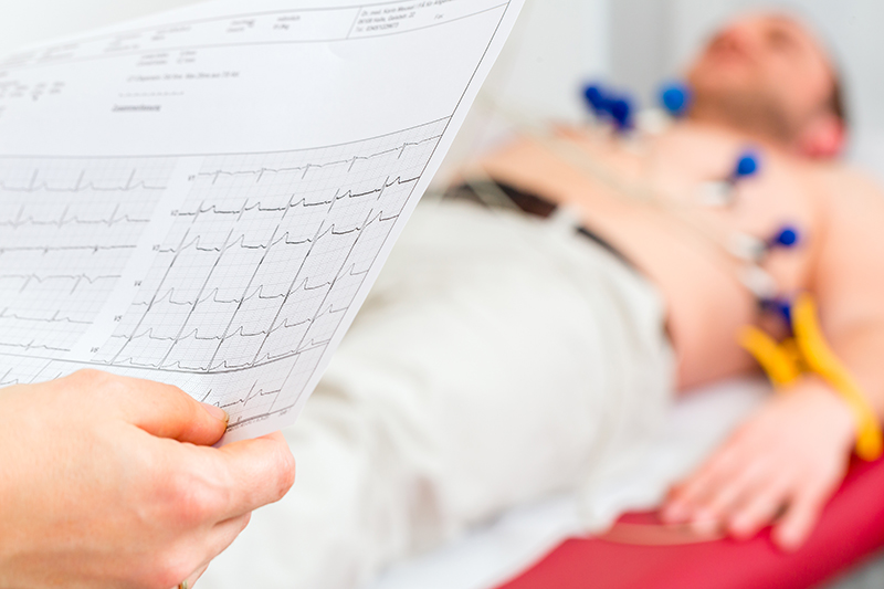 HOSPITAL REORGANIZA AGENDAMENTO DE ELETROCARDIOGRAMA